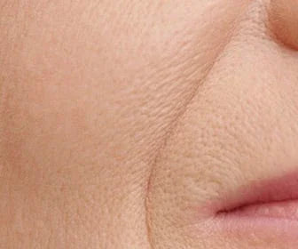 Skincare pelle con rughe (UNDER 40)