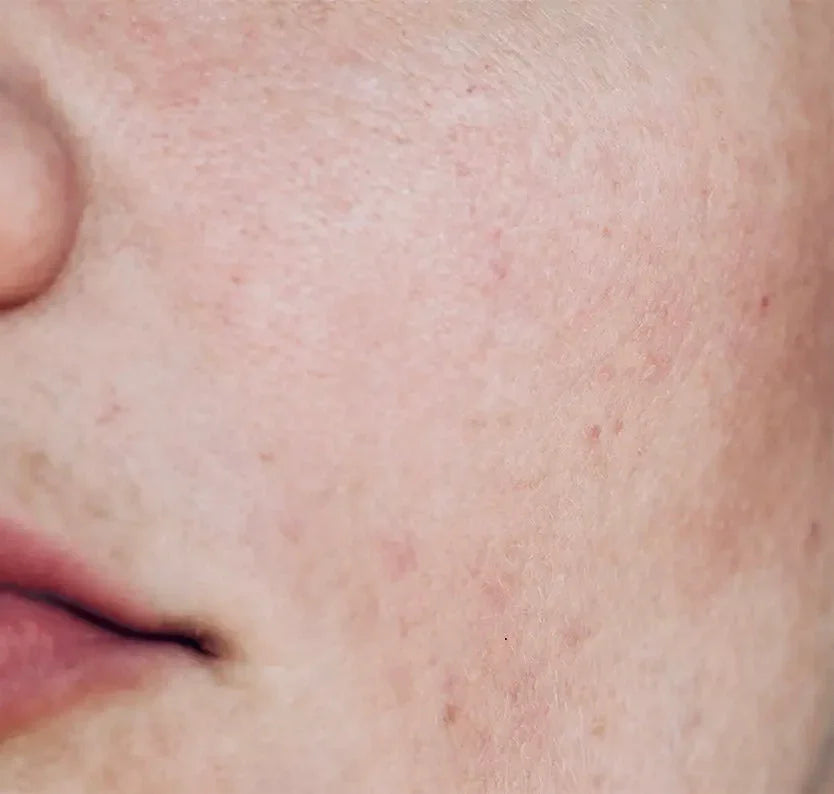 Skincare pelle spenta