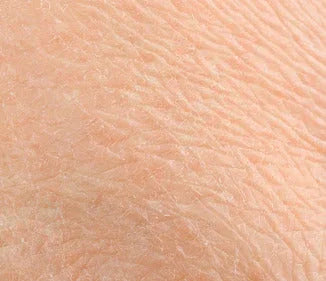 Skincare pelle secca