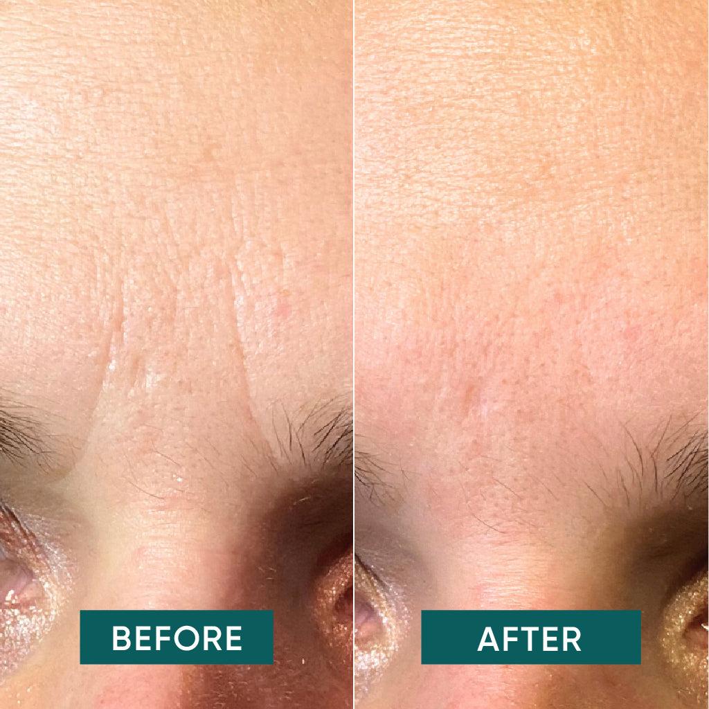 BEAUTY PATCH MONOUSO CON ACIDO IALURONICO PER IL VISO